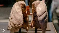 science-museum-body-world-2019-23