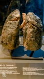 science-museum-body-world-2019-24