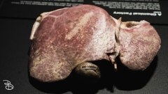 science-museum-body-world-2019-26