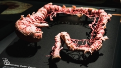 science-museum-body-world-2019-28