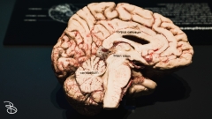 science-museum-body-world-2019-32
