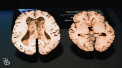 science-museum-body-world-2019-33