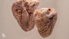 science-museum-body-world-2019-4