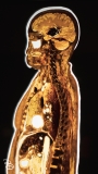 science-museum-body-world-2019-5